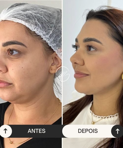 Imagem do WhatsApp de 2025-04-08 à(s) 19.51.30_165e0c8a